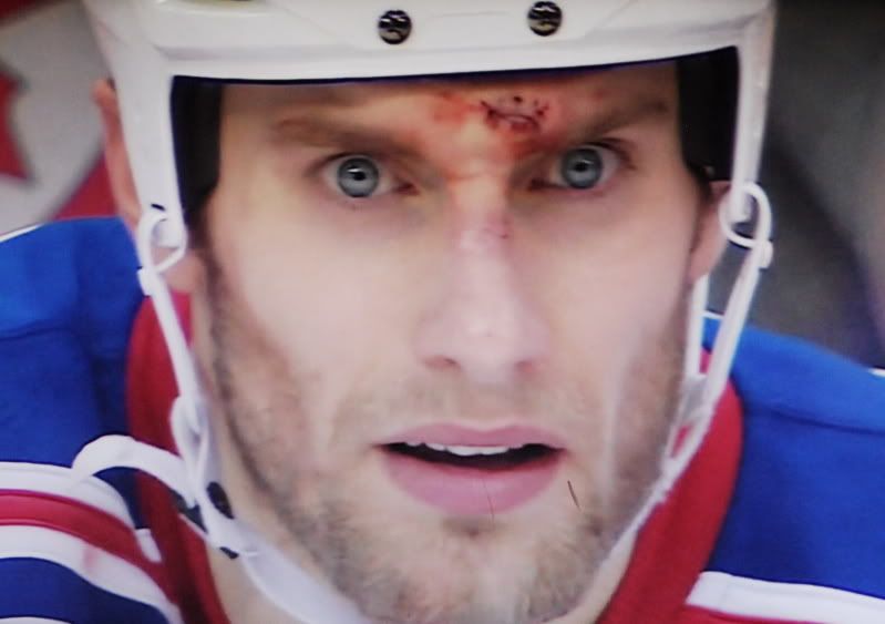 UPDATE NHL hockey what’s the fear of wearing ear protection,and